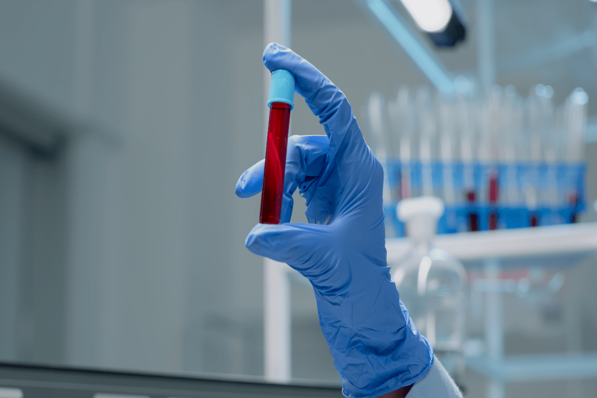 ДНК-тест крови в руке